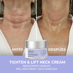Crema Reafirmante Antienvejecimiento para Cuello y Escote - ¡Reafirma, Levanta y Rejuvenece tu Piel!