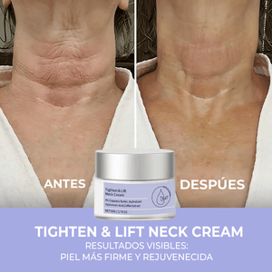 Crema Reafirmante Antienvejecimiento para Cuello y Escote - ¡Reafirma, Levanta y Rejuvenece tu Piel!